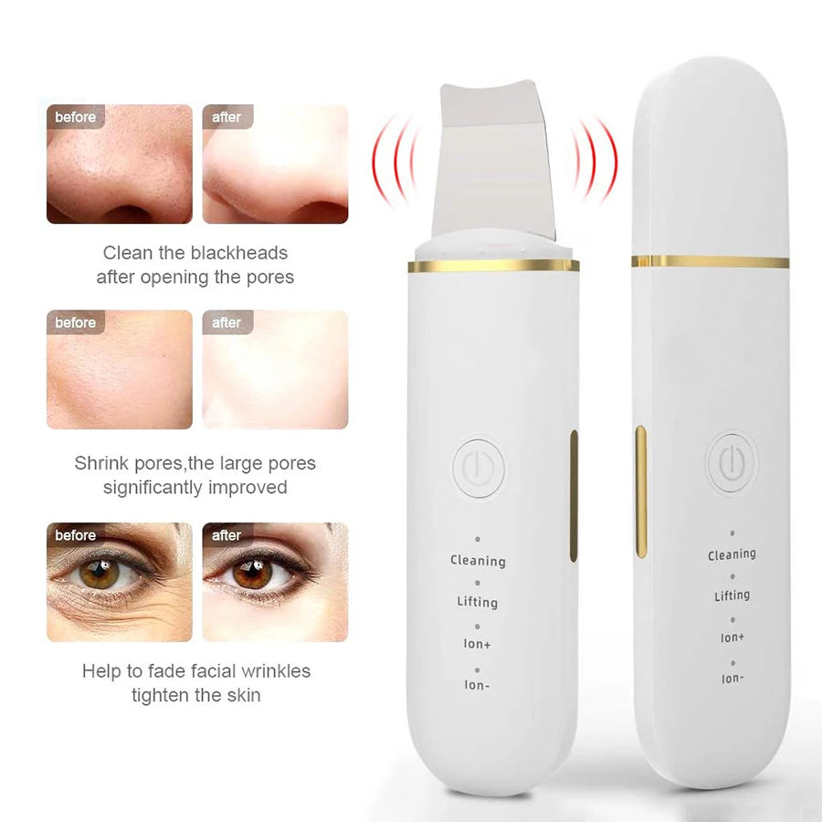 Ultrasonic Skin Scrub